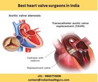 best heart valve surgeons in india image 1